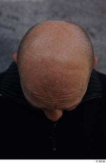 Street  584 bald hair head 0001.jpg